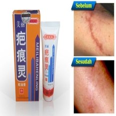 Obat Herbal Cream Penghilang Bekas Luka Mailibahenling