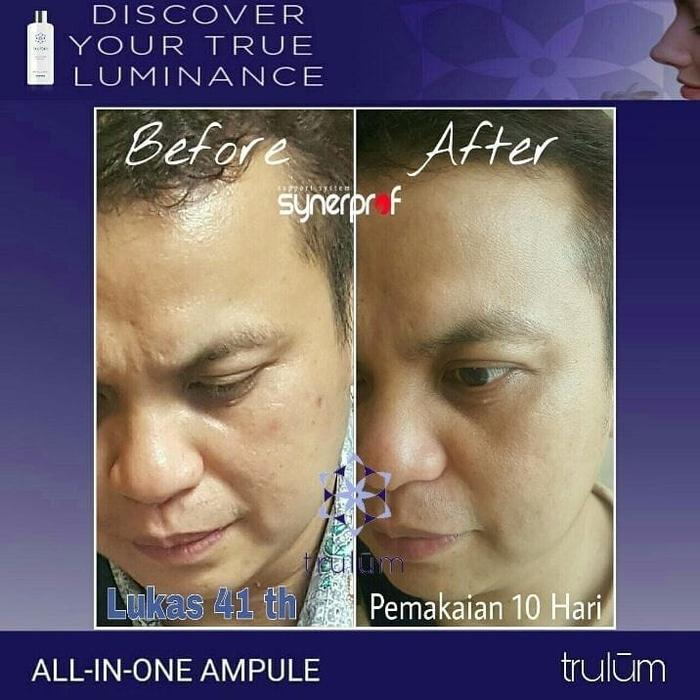 Trulum 5ml Januari 2019 - 2 Trulum 5ml - 2