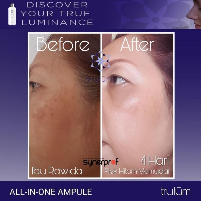 Trulum 5ml Januari 2019 - 3 Trulum 5ml - 3