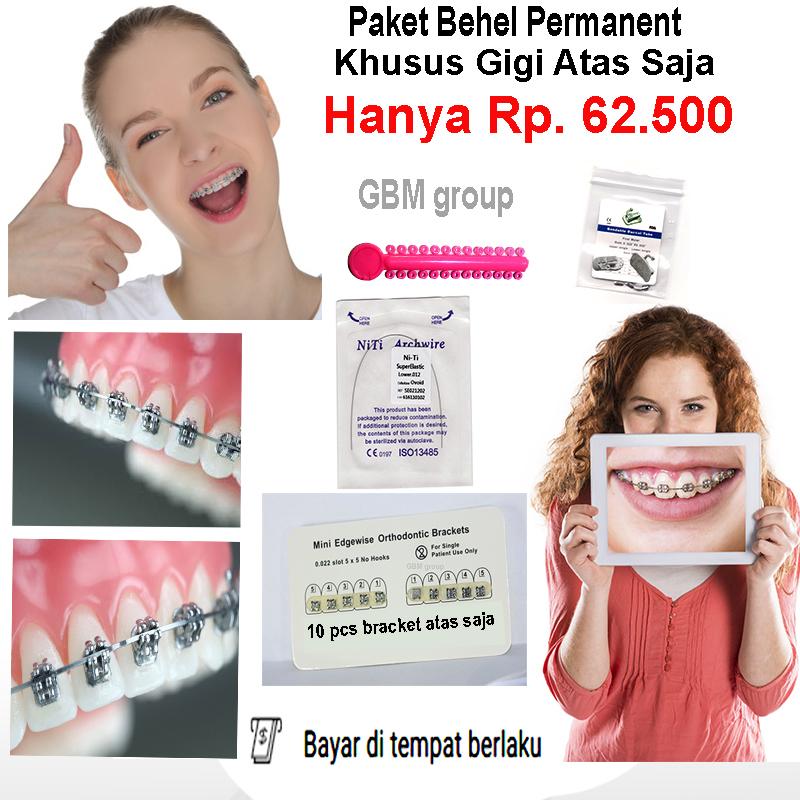 Turun Harga Paket Emas Ortho Behel Permanent 1 Rahang Atas Karet German