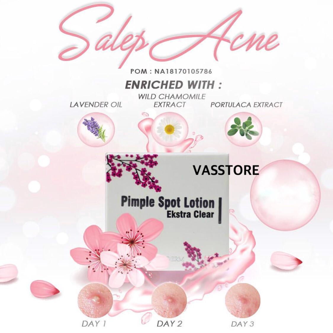 Vasstore MS Glow Pimple Spot Lotion / Acne Cream /Salep jerawat