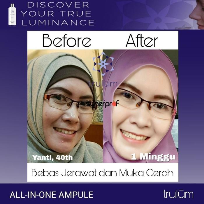 Trulum 5ml Januari 2019 - 5 Trulum 5ml - 5