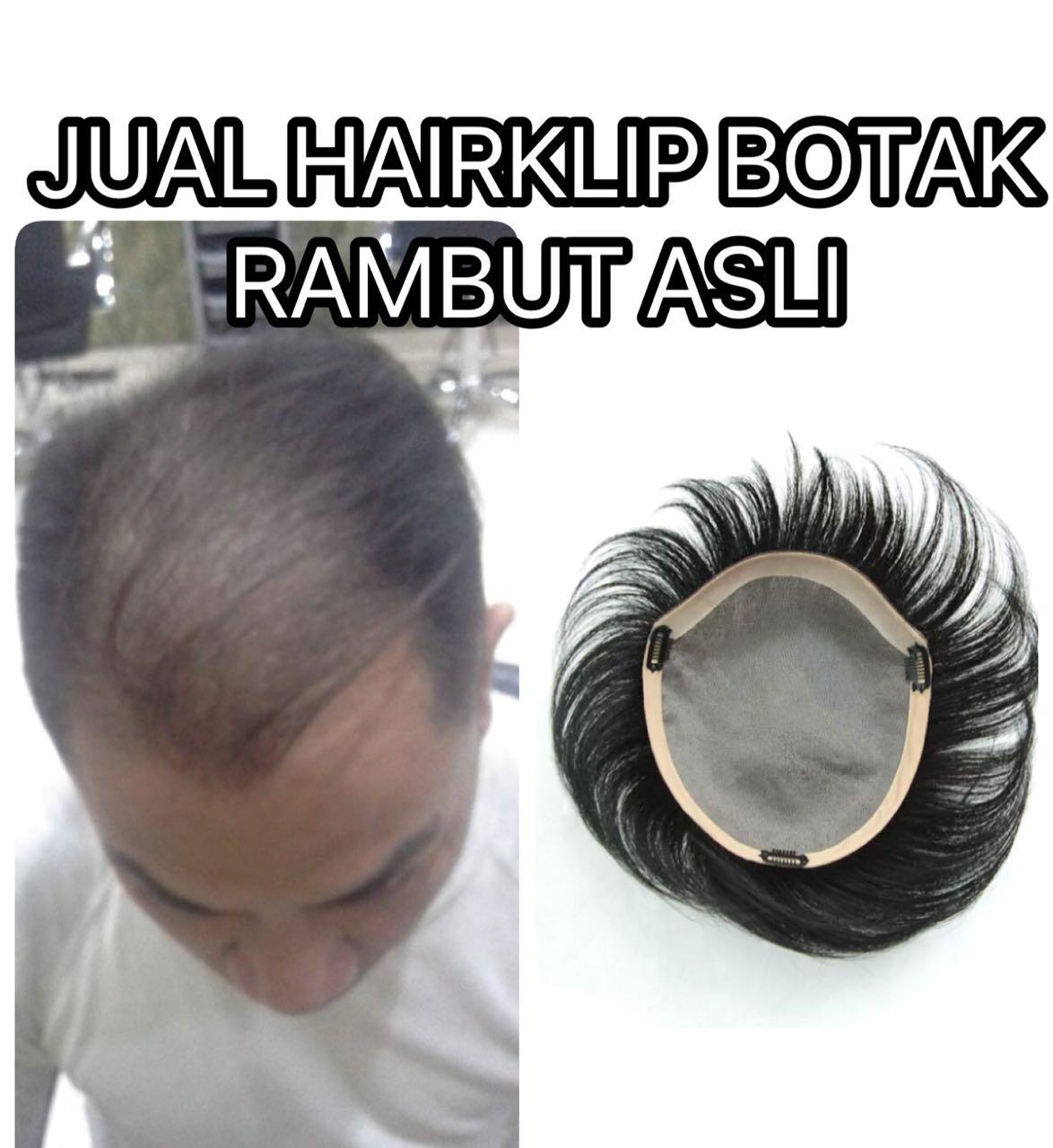 Hairclip - Hairklip - Penutup kebotakan - Human hair asli - Rambut asli - Real hair