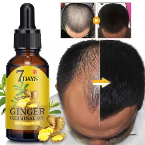 ภาพหน้าปกสินค้าSeaFlaker 【On Sale】 30ml Hair Nnt Sol Ginger Germinal Oil Serum Essence Oil Natural Hair Loss Treatment Effective Fast Growth Hair Care Essence Serum ที่เกี่ยวข้อง