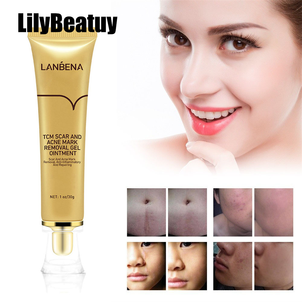 LANBENA Gel Trị Mụn Loại Bỏ Sẹo TCM 30G Kem Dưỡng Da Hiệu Quả Trị Vết Rạn Da Mụn Nhọt